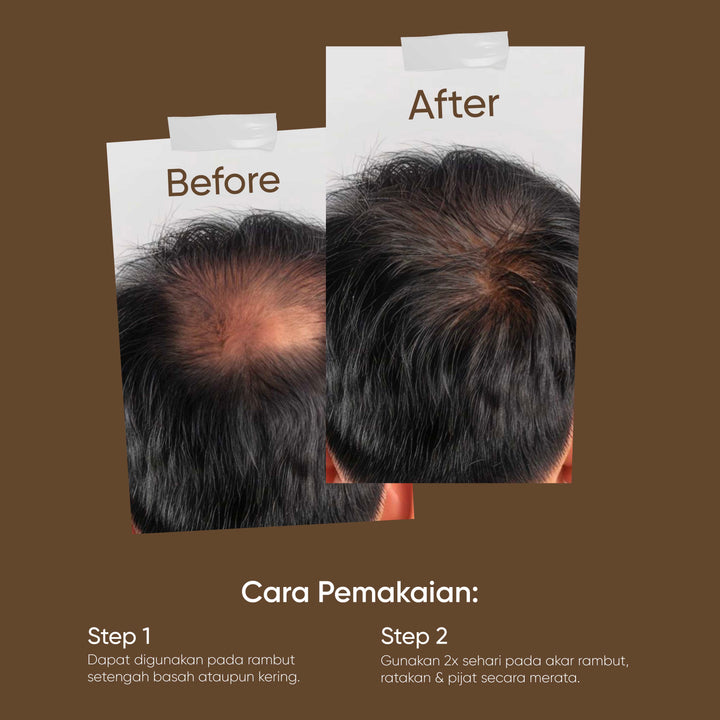 Votre Peau Hair Tonic with Ginseng and Chestnut Seeds Extract 100ml