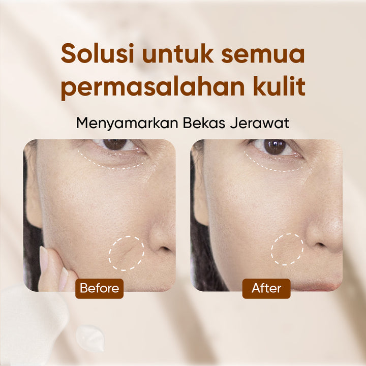 Votre Peau Serum Retinol Concentrate 30ml