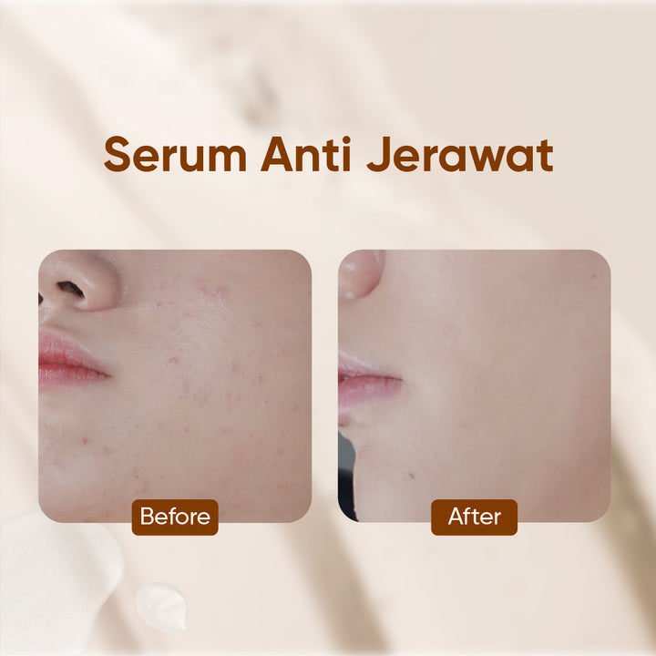 Votre Peau Skin Care Vitamin C Serum 30ml