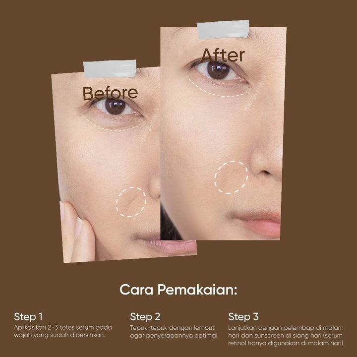 Votre Peau Serum Retinol Concentrate 30ml - NEAR ED JUN 27