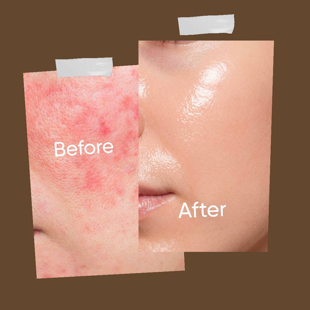 Biograft Glass Skin Perfect Duo