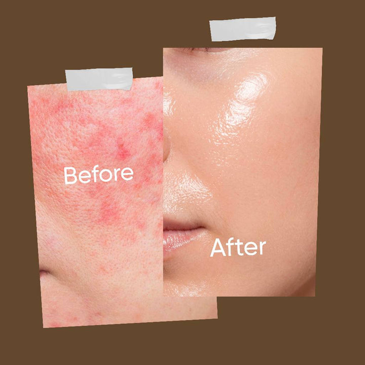 Biograft Glass Skin Perfect Duo