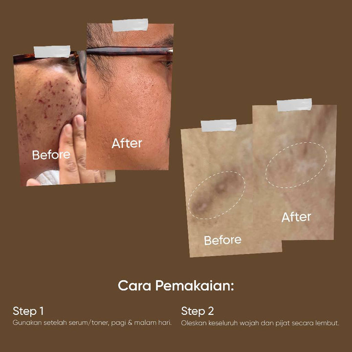 Biograft Salmon DNA Recovery Gel With Centella Asiatica