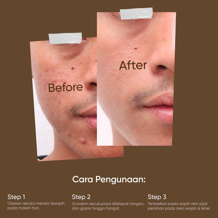 Votre Peau Skin Care Retinol Barrier Cream 12,5gr - Krim Jerawat dan Anti Aging Penuaan